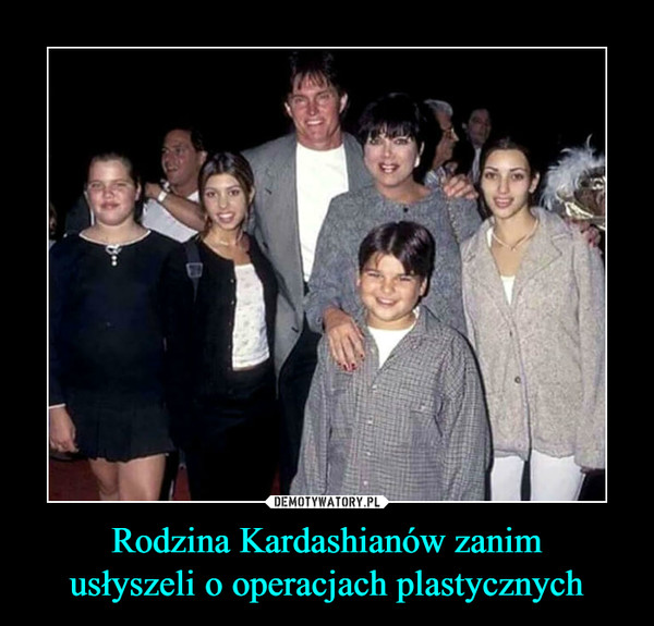 Rodzina Kardashianów zanimusłyszeli o operacjach plastycznych –  