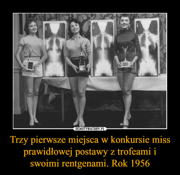 Trzy pierwsze miejsca w konkursie miss prawidłowej postawy z trofeami i swoimi rentgenami. Rok 1956