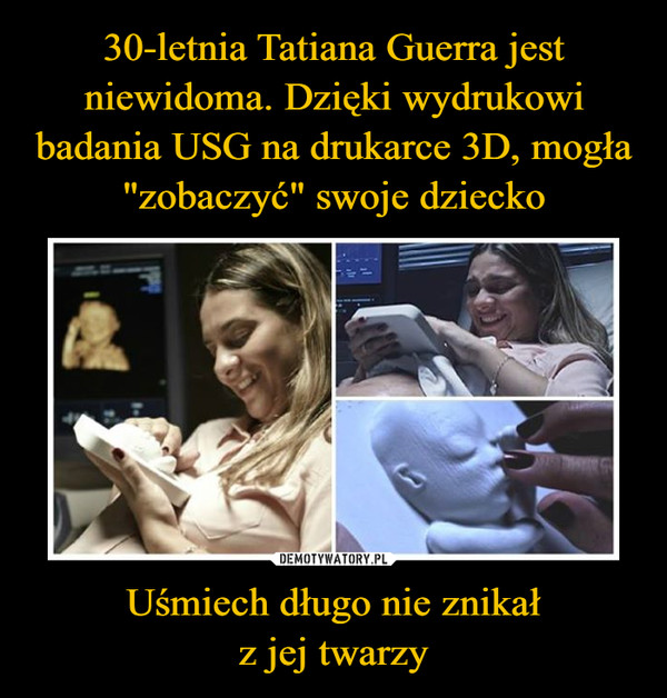 30-letnia Tatiana Guerra jest niewidoma. Dzięki wydrukowi badania USG na drukarce 3D, mogła "zobaczyć" swoje dziecko Uśmiech długo nie znikał
z jej twarzy