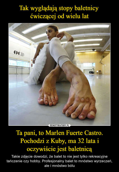 Tak wyglądają stopy baletnicy 
ćwiczącej od wielu lat Ta pani, to Marlen Fuerte Castro. Pochodzi z Kuby, ma 32 lata i oczywiście jest baletnicą