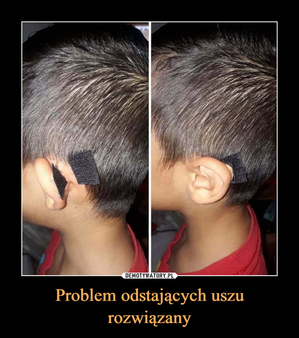 Problem odstających uszu rozwiązany